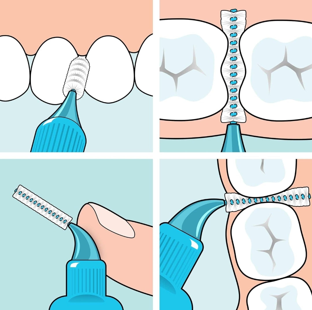 brossettes interdentaires